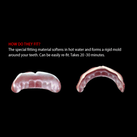 The Scream Team FX Teeth | Lucius | Fangs